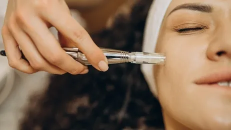 หมอใช้เครื่องรักษาหลุมสิวจิ้มบริเวณใบหน้าผู้หญิง